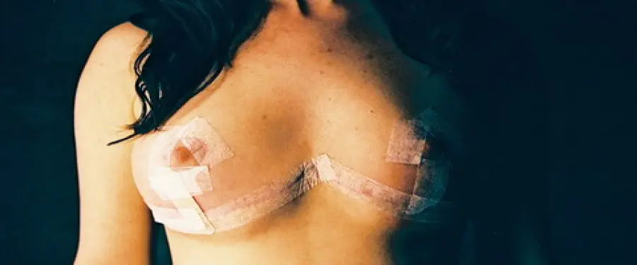 Mastoplastica: gli specialisti delle protesi al seno di Roma